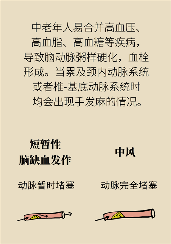 無(wú)緣無(wú)故的手麻，這是身體發(fā)出的什么信號(hào)？