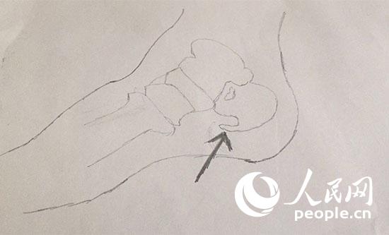 骨刺科普動(dòng)漫制作 腿腳疼痛就買膏藥治骨刺?別被不良商家誤導(dǎo)了