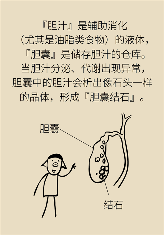 結(jié)石科普：身體里多了各種結(jié)石，應(yīng)該怎么辦？