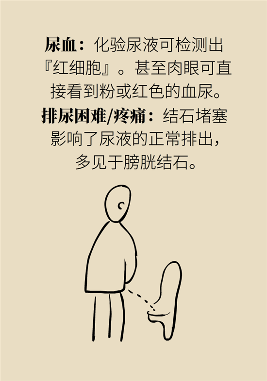 結(jié)石科普：身體里多了各種結(jié)石，應(yīng)該怎么辦？