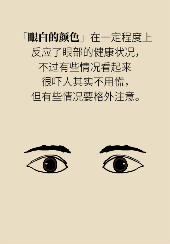 眼白有斑塊、出血要緊嗎？專家：名字唬人但問(wèn)題不大