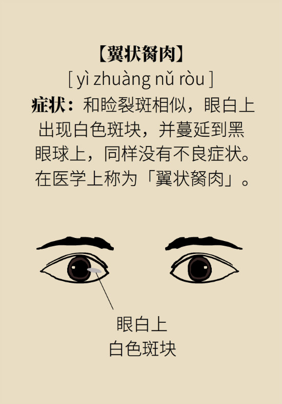 眼白有斑塊、出血要緊嗎？專家：名字唬人但問(wèn)題不大