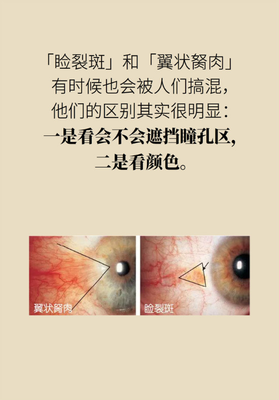 眼白有斑塊、出血要緊嗎？專家：名字唬人但問(wèn)題不大
