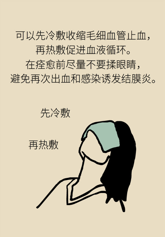 眼白有斑塊、出血要緊嗎？專家：名字唬人但問(wèn)題不大