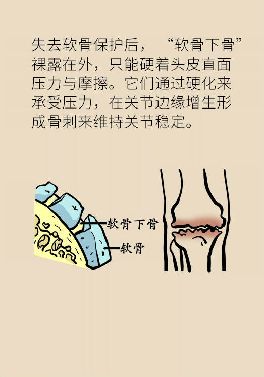 人老關(guān)節(jié)也會(huì)老嗎？