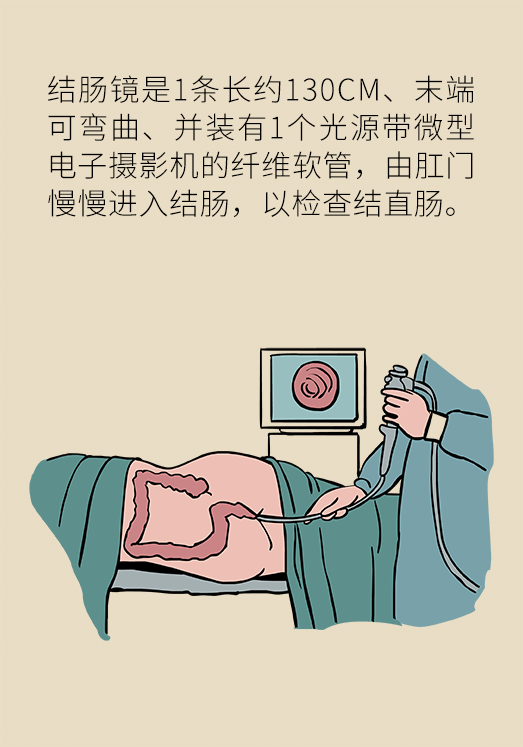 患潰瘍性結腸炎該怎么辦？結腸鏡檢查了解一下