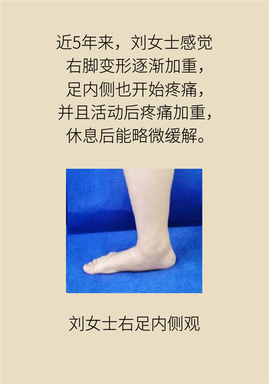 走幾百米路就疼得不行了？可能患上了平足癥