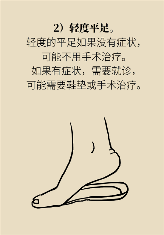 走幾百米路就疼得不行了？可能患上了平足癥