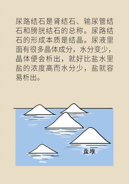 結(jié)石科普動(dòng)漫制作 結(jié)石科普動(dòng)漫制作