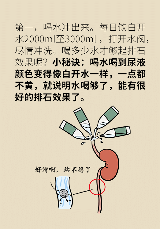 結(jié)石科普動(dòng)漫制作 結(jié)石科普動(dòng)漫制作