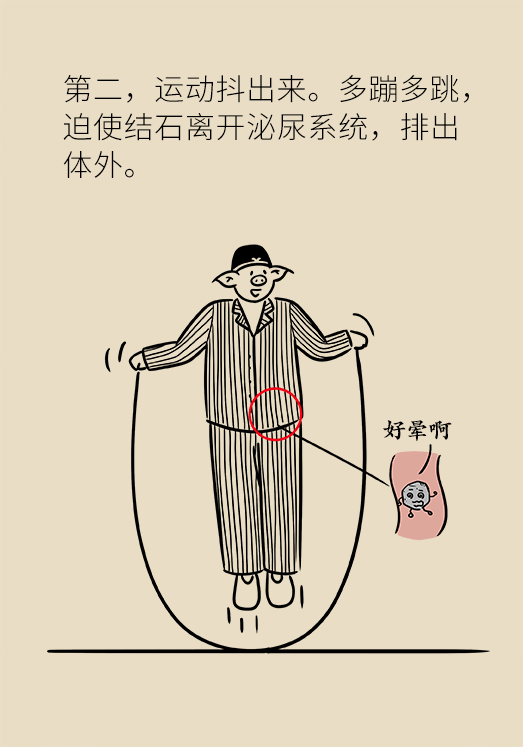 結(jié)石科普動(dòng)漫制作 結(jié)石科普動(dòng)漫制作