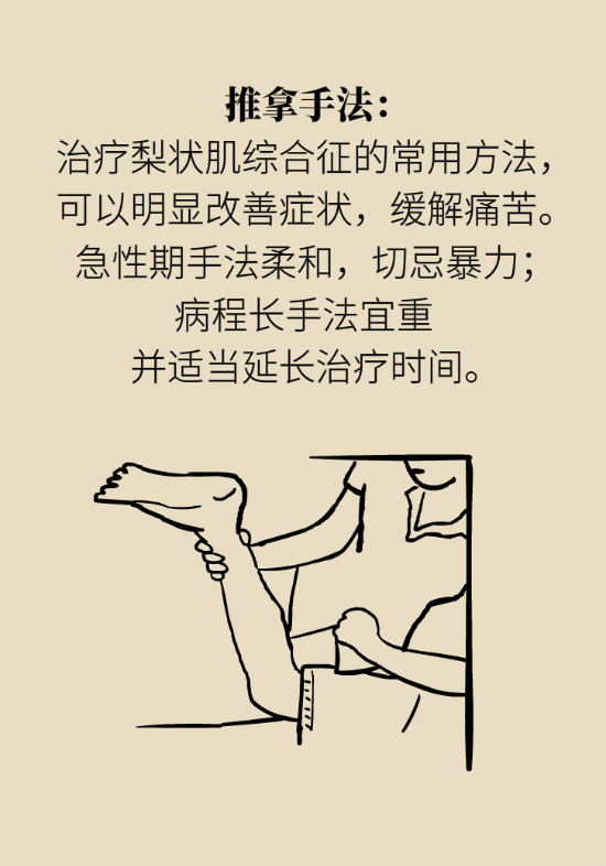 梨狀肌綜合征 梨狀肌綜合征
