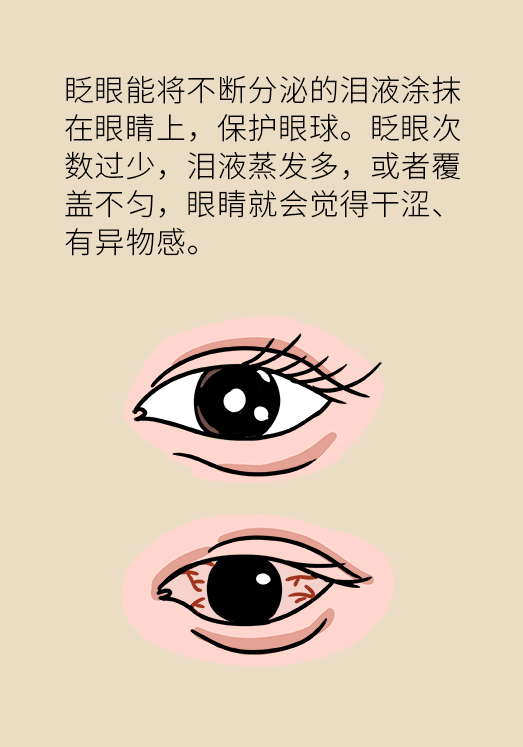 熬夜追劇后眼睛干澀疼痛？