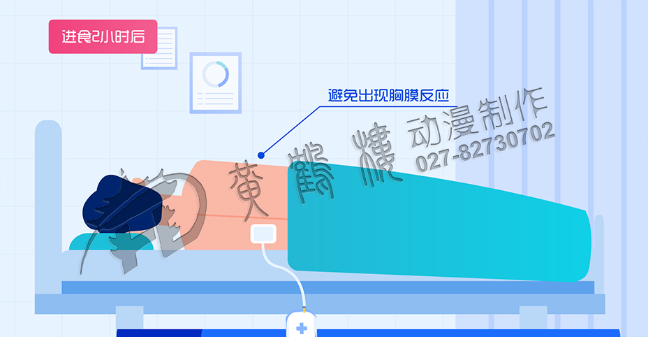 醫(yī)學(xué)動(dòng)畫(huà)制作公司 醫(yī)學(xué)動(dòng)畫(huà)制作公司