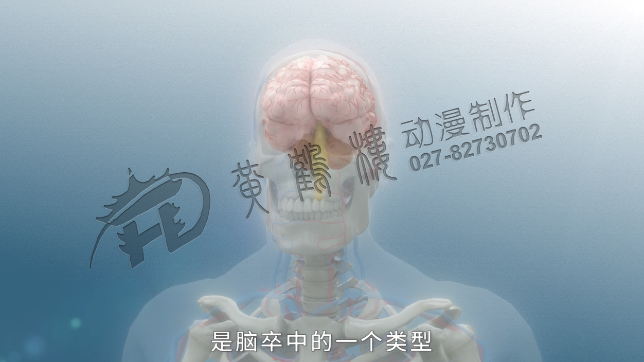 《缺血性腦卒中》三維醫(yī)療科普動畫宣傳片.jpg