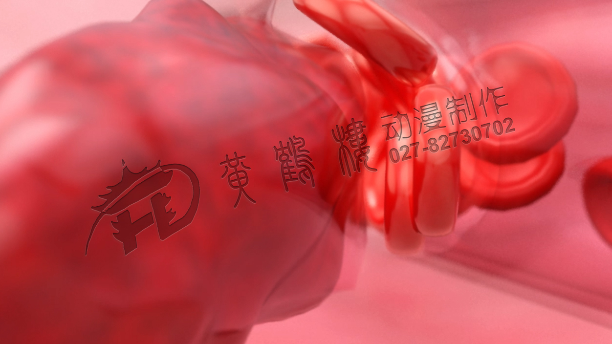 腦栓塞動畫制作.jpg