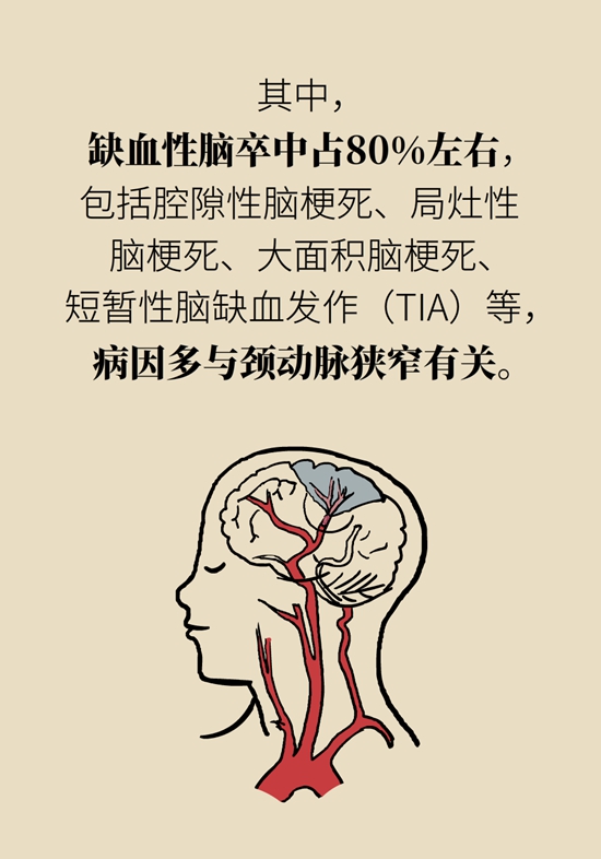 中風