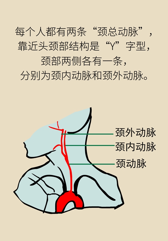 中風