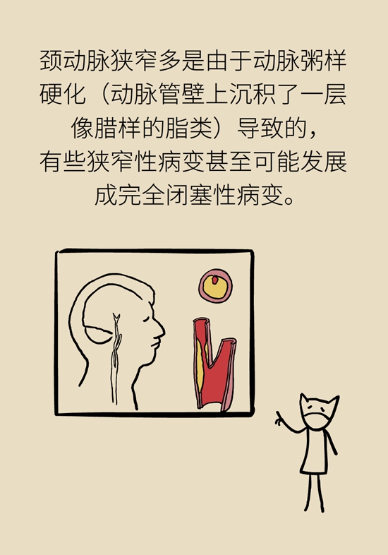 中風