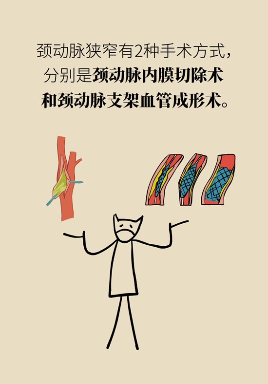 中風