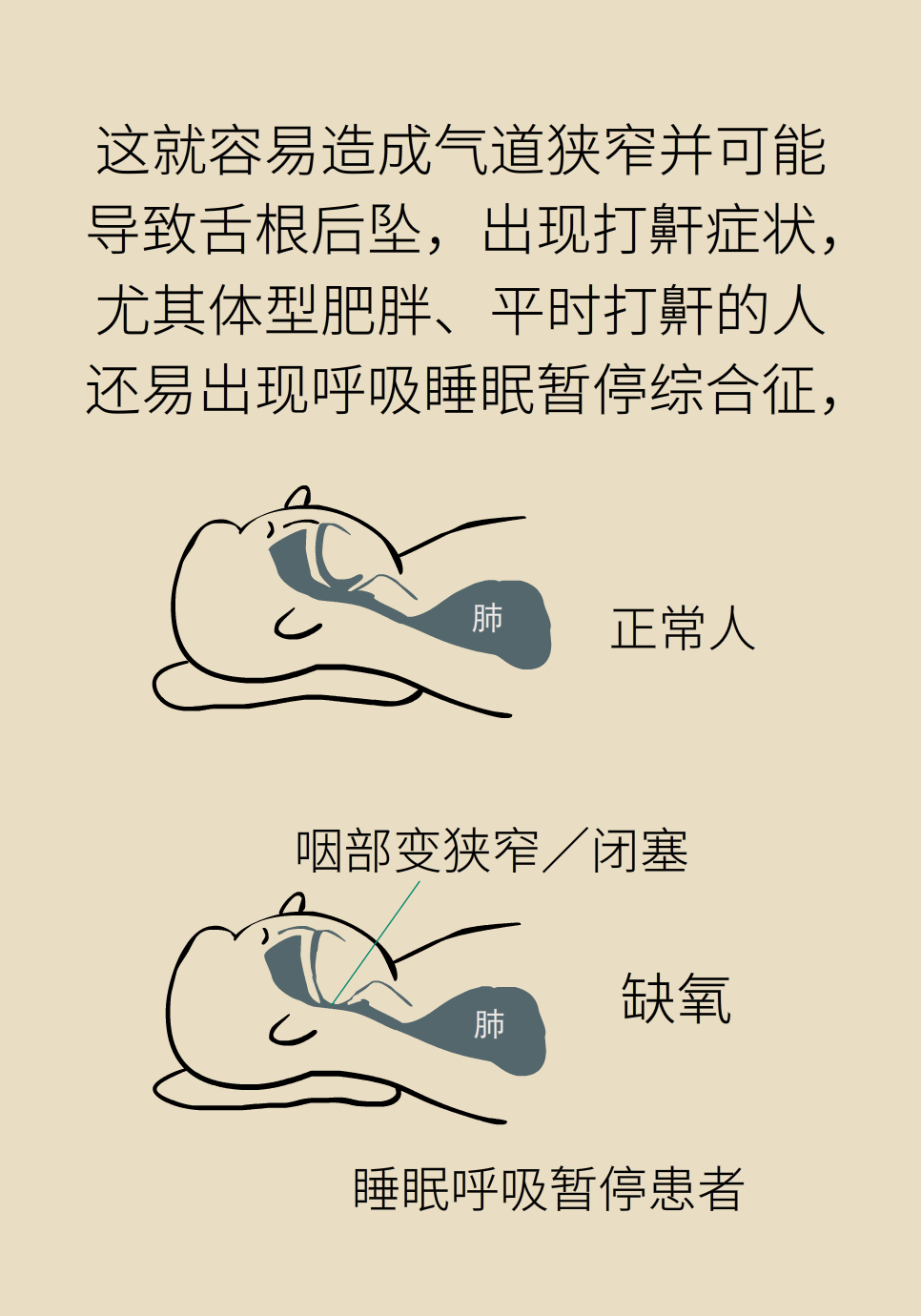 失眠醫(yī)學科普動漫制作