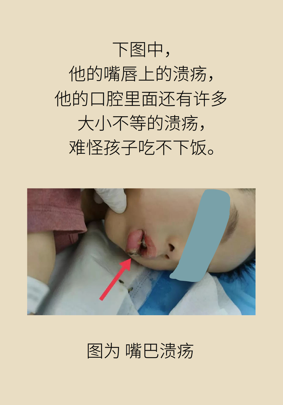 長白塞病醫(yī)學(xué)知識科普動畫制作