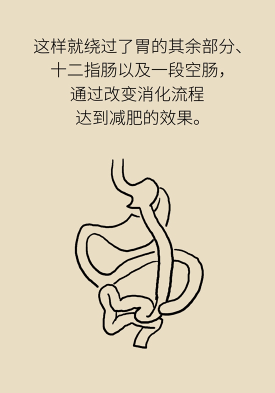 減肥醫(yī)學知識科普