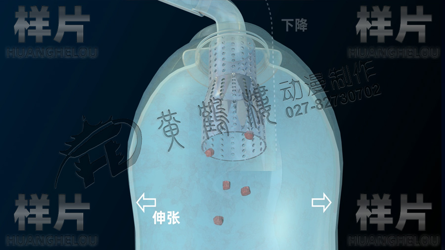 抗反流.jpg 抗反流.jpg