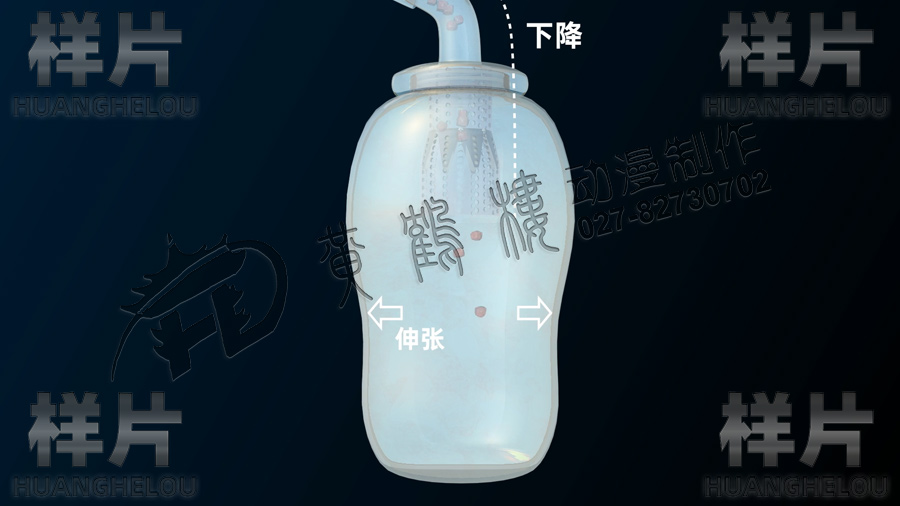 前列腺組織回收.jpg 前列腺組織回收.jpg