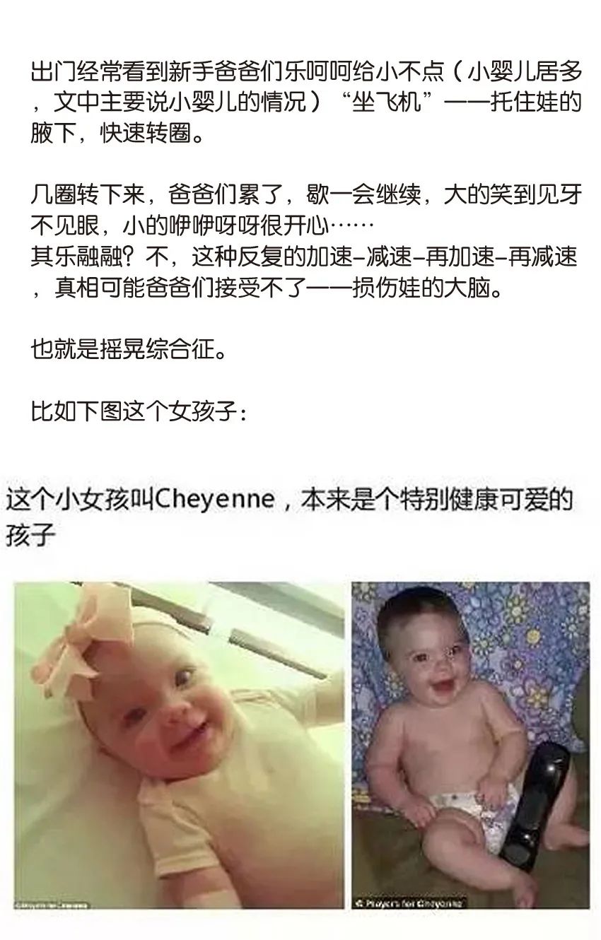 育兒醫(yī)學科普:大力搖晃會損傷寶寶的大腦致腦損傷