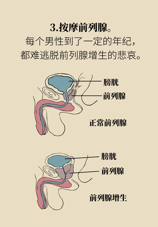 怎么做可以預防痔瘡呢？按摩前列腺、鍛煉盆底肌